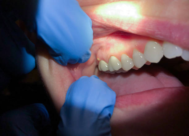 Best Knocked-Out Tooth Emergency  in Mp Pendleton South, CA